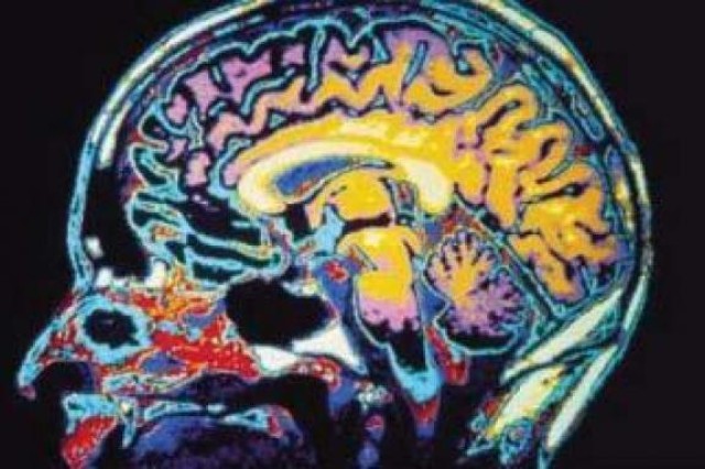 Brain function increased with haritaki research indicates