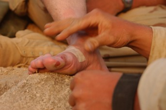 Beware the blister: a \u0027minor injury\u0027 that can slow you down with serious pain - Article - The United States Army