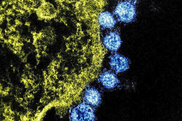 The Centers for Disease Control and Prevention has said that the COVID-19 or the novel coronavirus, is similar to the Middle East Respiratory Syndrome coronavirus in that it is spread from animals to people. The MERS virus particles are in blue, surrounding an infected cell.